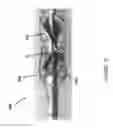 Fig. 23 - CATHETER PUMP ASSEMBLY INCLUDING A STATOR