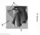 Fig. 24 - CATHETER PUMP ASSEMBLY INCLUDING A STATOR