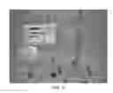 Fig. 04 - PATIENT WARMING SYSTEM