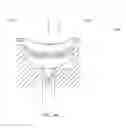 Fig. 46 - Adhesive and peripheral systems and methods for medical devices