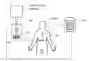 Fig. 01 - Respiratory parameter guided automated IV administration and IV tube clamp activation