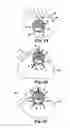 Fig. 11 - DEVICES, SYSTEMS, AND RELATED METHODS FOR DELIVERY OF FLUID TO TISSUE