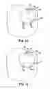 Fig. 18 - DEVICES, SYSTEMS, AND RELATED METHODS FOR DELIVERY OF FLUID TO TISSUE