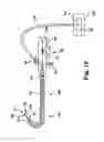 Fig. 20 - DEVICES, SYSTEMS, AND RELATED METHODS FOR DELIVERY OF FLUID TO TISSUE