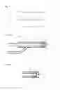 Fig. 02 - Supply system for creating a pulsed fluid jet, application system having supply system and control process for operating a supply system