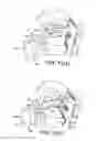 Fig. 16 - Delivery Device and Method