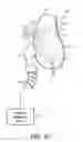 Fig. 11 - DETECTING THE FIT OF A PATIENT INTERFACE DEVICE