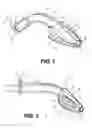 Fig. 02 - Artificial airway