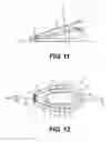 Fig. 05 - Artificial airway