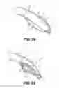Fig. 13 - Artificial airway