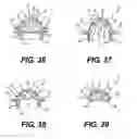 Fig. 14 - Artificial airway