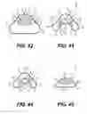 Fig. 16 - Artificial airway