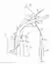 Fig. 17 - Artificial airway