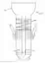 Fig. 01 - Emergency tracheotomy device