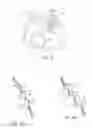 Fig. 05 - Seal for a patient interface, interface assemblies and aspects thereof