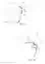 Fig. 16 - Seal for a patient interface, interface assemblies and aspects thereof