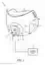 Fig. 02 - Fluid coupling member including valve member