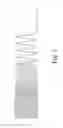 Fig. 03 - Unravelable catheter
