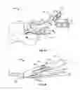 Fig. 07 - Systems and methods for anchoring medical devices