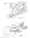 Fig. 10 - Systems and methods for anchoring medical devices