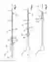 Fig. 02 - Safety clip for Seldinger cannula