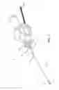 Fig. 02 - Over-the-needle guidewire vascular access systems and methods
