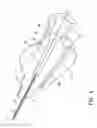 Fig. 05 - Over-the-needle guidewire vascular access systems and methods