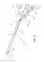 Fig. 06 - Over-the-needle guidewire vascular access systems and methods
