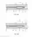 Fig. 04 - Balloon catheter with elastomeric sheath and methods