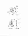 Fig. 17 - METHODS AND DEVICES FOR INTRA-ATRIAL SHUNTS HAVING SELECTABLE FLOW RATES