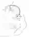 Fig. 01 - Detection and clearing of occlusions in catheters