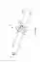 Fig. 24 - Electrically-induced fluid filled balloon catheter