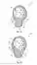 Fig. 09 - SELF EXPANDING ELECTRODE CUFF