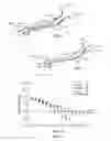 Fig. 05 - Method of stimulating a hypoglossal nerve for controlling the position of a patient's tongue