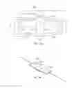 Fig. 04 - Modulation of autonomic nervous system activity and integrated electrode assemblies for trigeminal neurostimulation