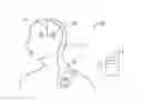 Fig. 01 - Variable frequency stimulation therapy method and implantable medical device