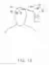 Fig. 14 - Variable frequency stimulation therapy method and implantable medical device