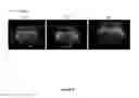 Fig. 09 - REGENERATION OF NERVE FIBERS