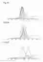 Fig. 04 - LIGHT EMITTING DEVICE FOR BODY HAIR