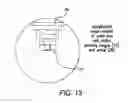 Fig. 12 - Direct visualization Robotic Intra-Operative Radiation Therapy Device with Radiation Ablation Capsule and Shutter System