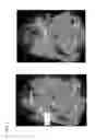 Fig. 09 - System for delivering conformal radiation therapy while simultaneously imaging soft tissue