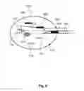 Fig. 03 - System and method for visualizing information in a procedure of placing sources