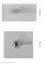 Fig. 24 - Combined local delivery of therapeutic agents using interventional devices and radiation