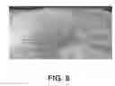 Fig. 09 - SYSTEMS AND METHODS FOR TREATING ABSCESSES AND INFECTED FLUID COLLECTIONS