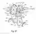 Fig. 13 - Exercise apparatus