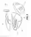 Fig. 04 - MULTI-ZONE GOLF CLUB HEADS
