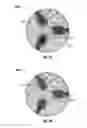 Fig. 15 - MANUFACTURE OF CUTTING ELEMENTS HAVING LOBES