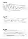 Fig. 11 - PINCHING TOOL