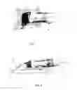 Fig. 03 - Guide foot for an oscillating cutting tool