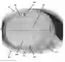 Fig. 01 - Method of manufacturing a medical device for external application to the head of a patient